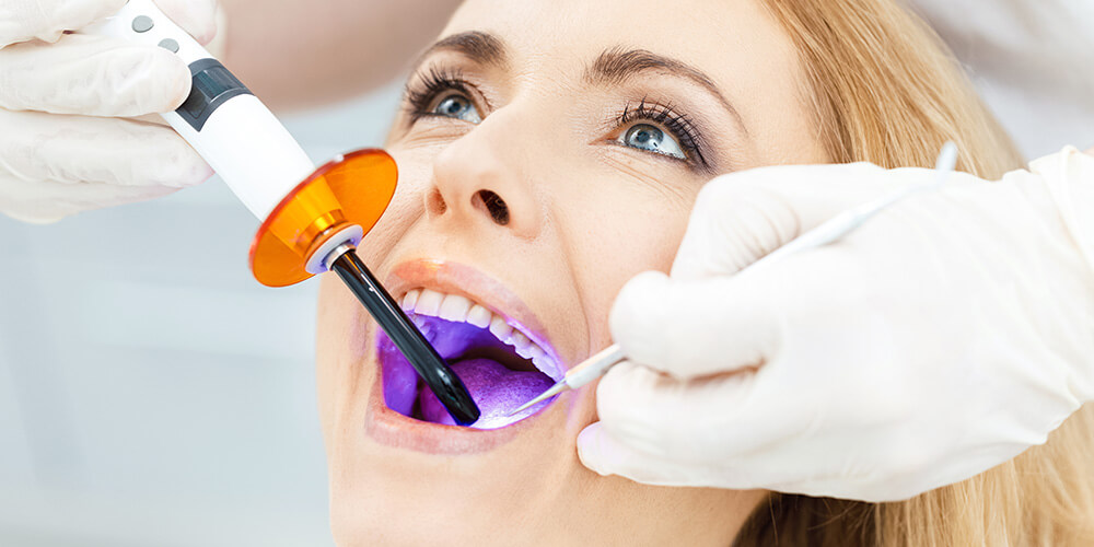 Dental Bonding Etobicoke