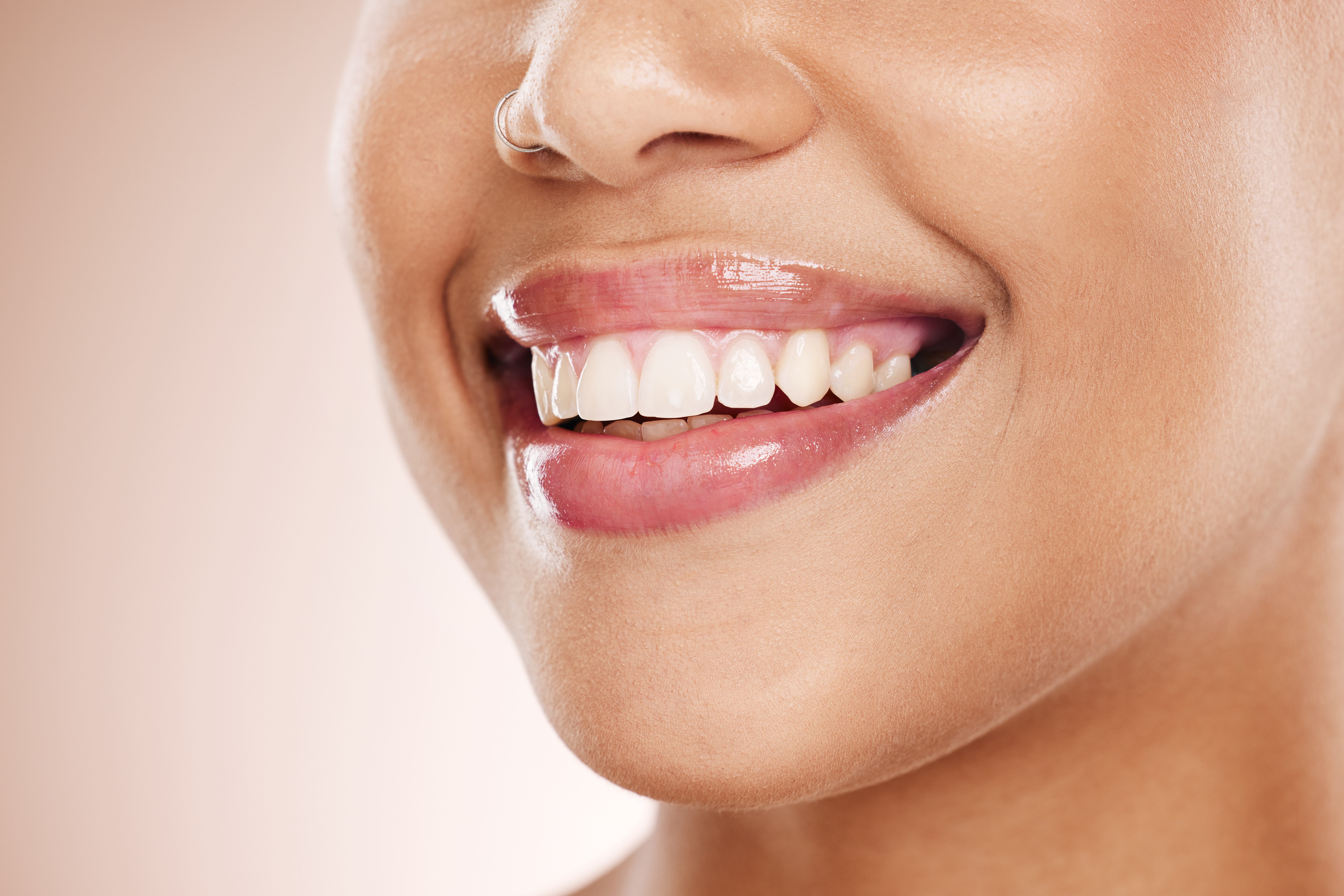 Fluoride Treatment Etobicoke