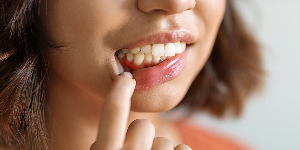 Periodontal Therapy Etobicoke