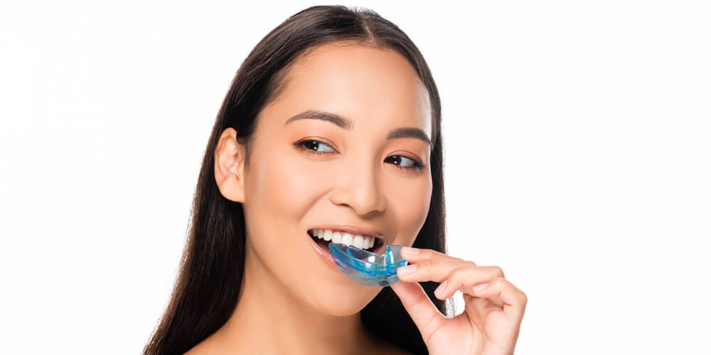 TMD/Bruxism Night Guards Etobicoke